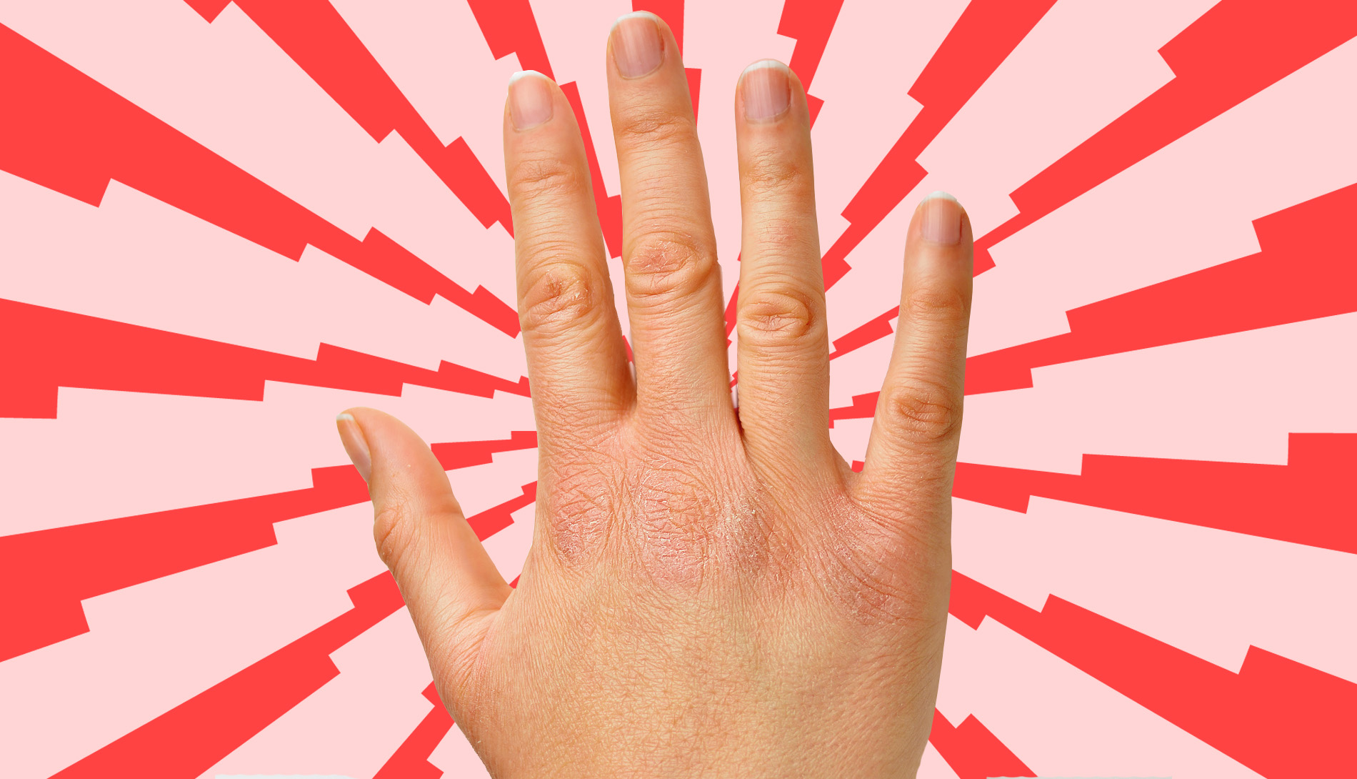 Dag Kloofjes Schilfertjes En Velletjes Hallo Poezelige Handjes 7 Tips Voor Handverzorging In De Zorg Floorzorgt Nl