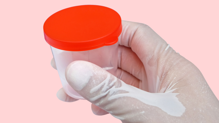 sputum-patiënt-kleur-indicatie