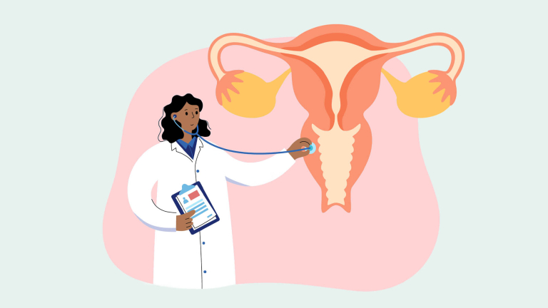 endometriose