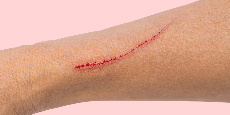 Aggressie-clienten-verpleeghuis