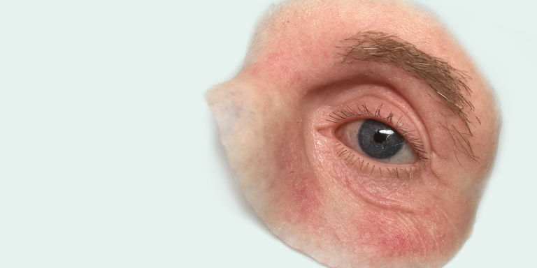 aangezichtsprotheticus-gelaatsprotheses-gelaatsprothetiek 