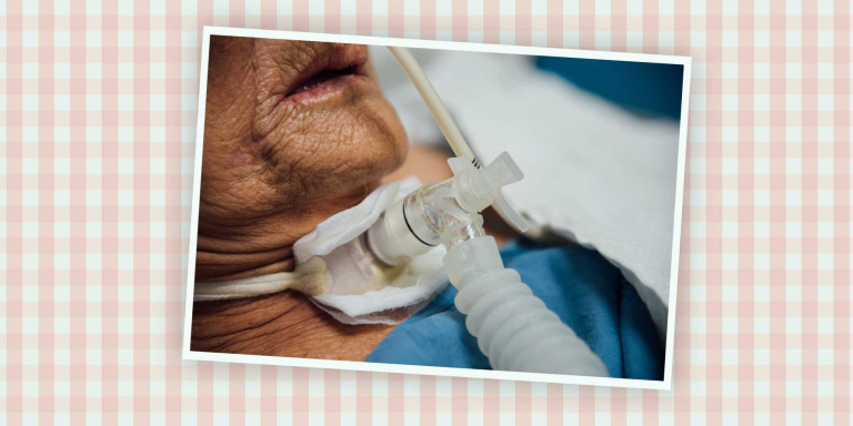 toos-beademing-stoma